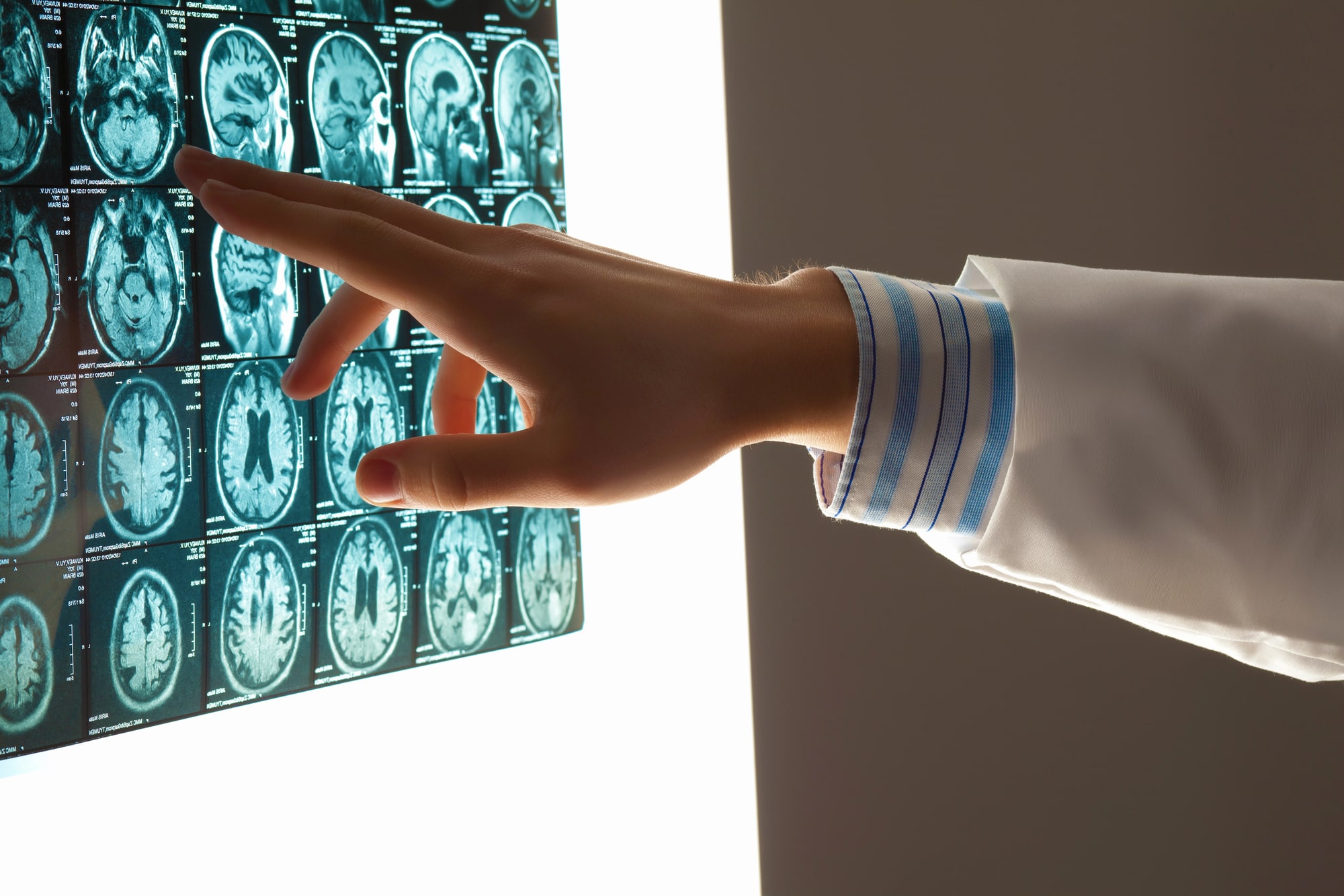 brain injury lawyer in McCracken County, KY