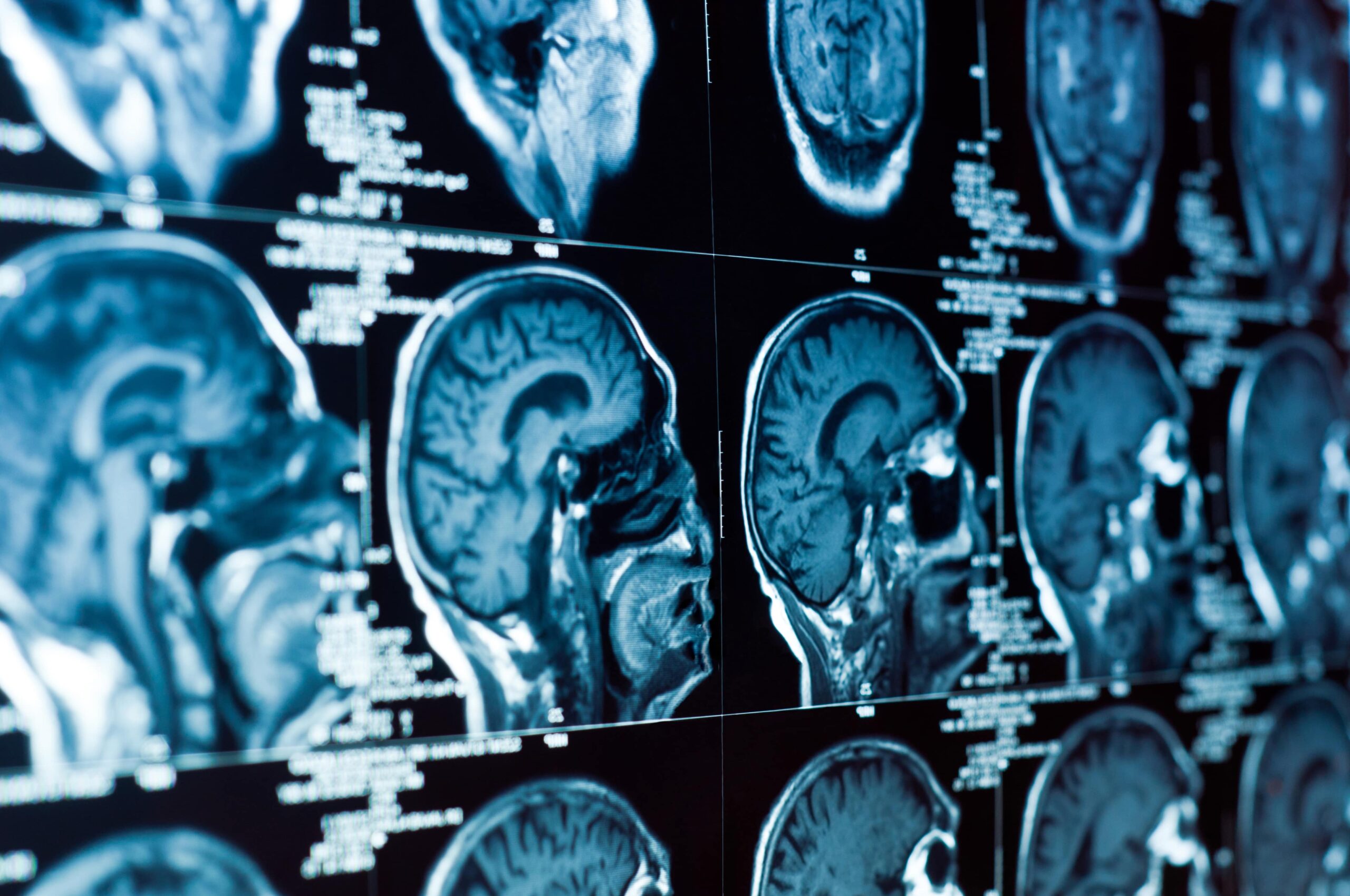 brain injury lawyer McCracken County, KY faqs
